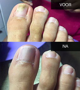 Zie wat de behandeling voor u kan doen